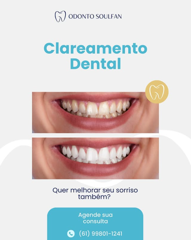 Clareamento Dental